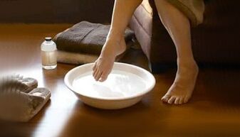 Tradicionalne metode liječenja gljivica na nožnim prstima