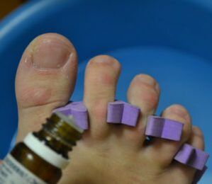 Priprema za liječenje noktiju kapima protiv gljivica